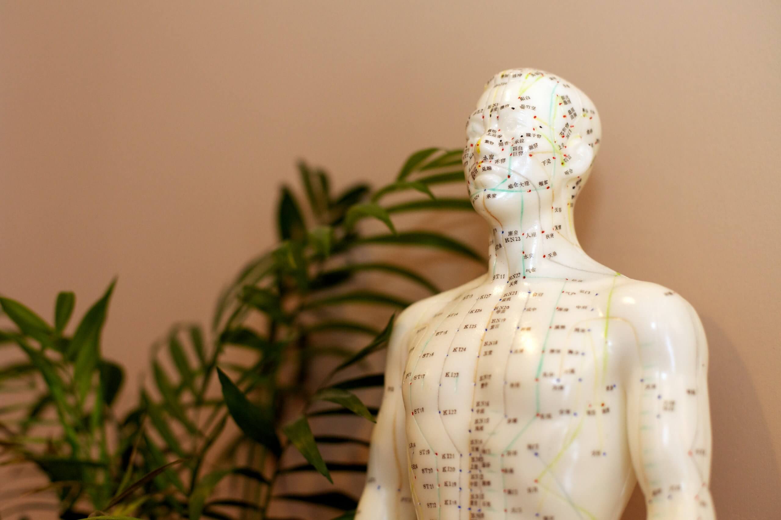 Acupuncture treatment for wellness Acupuncturist in Milton Acupuncture treatment for wellness Acupuncturist in Milton