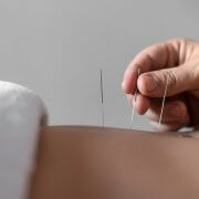Acupuncture Therapy in Milton